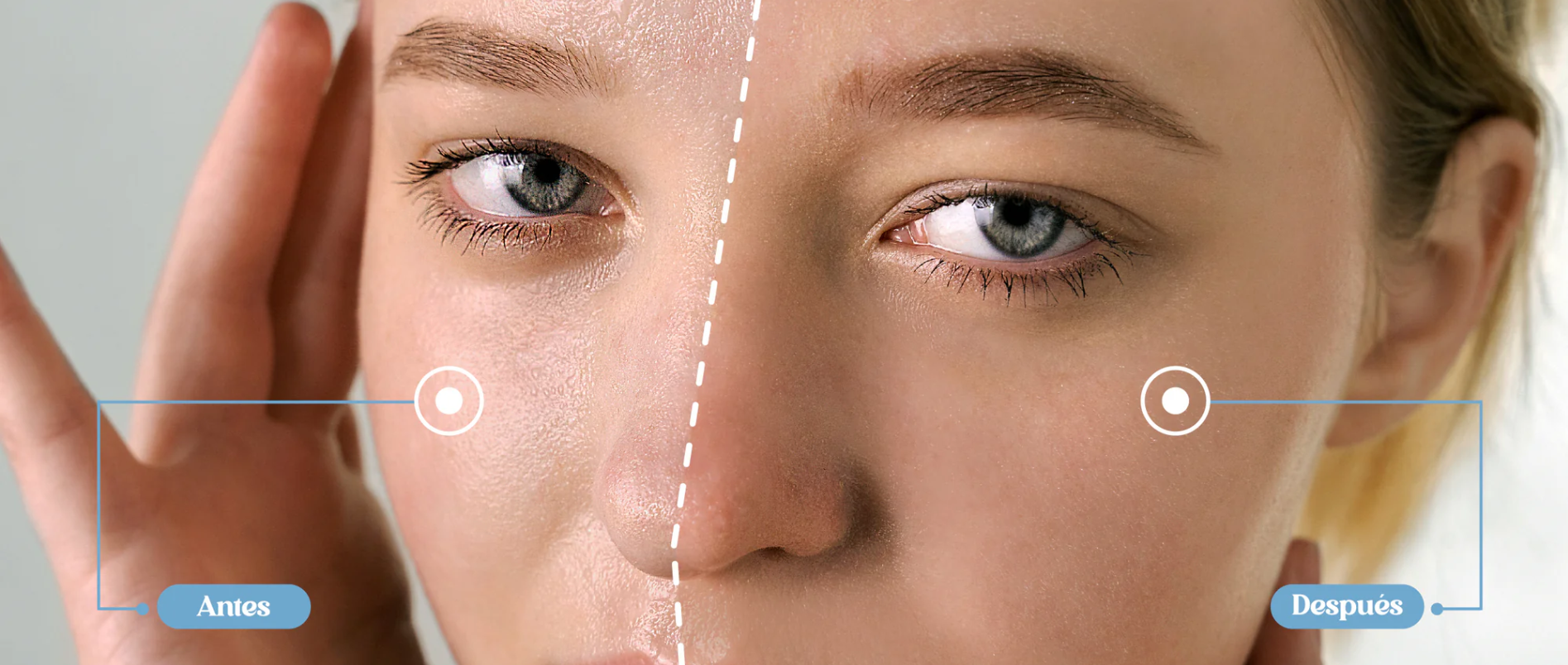 CANDY BELLA® | GEL PRENSADO PARA CONTROL DE GRASA FACIAL